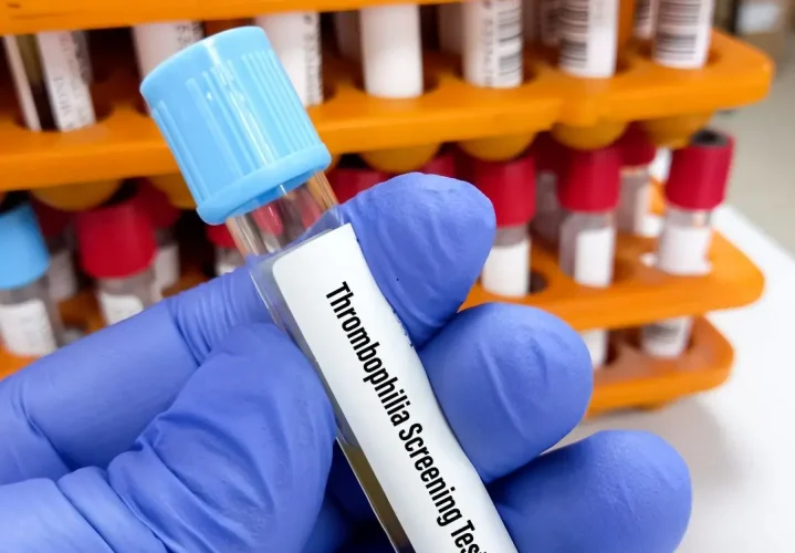 Como Obter Enoxaparina Sódica Gratuitamente Através do SUS para Gestantes com Trombofilia
